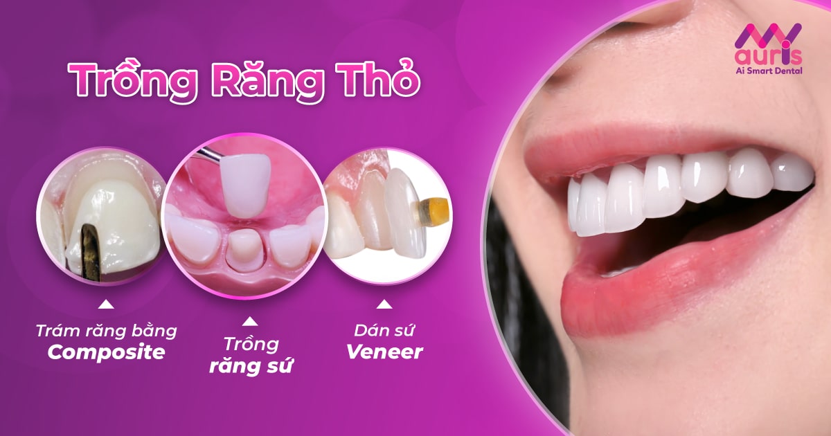 Trồng răng thỏ là gì? Bằng các phương pháp nào?