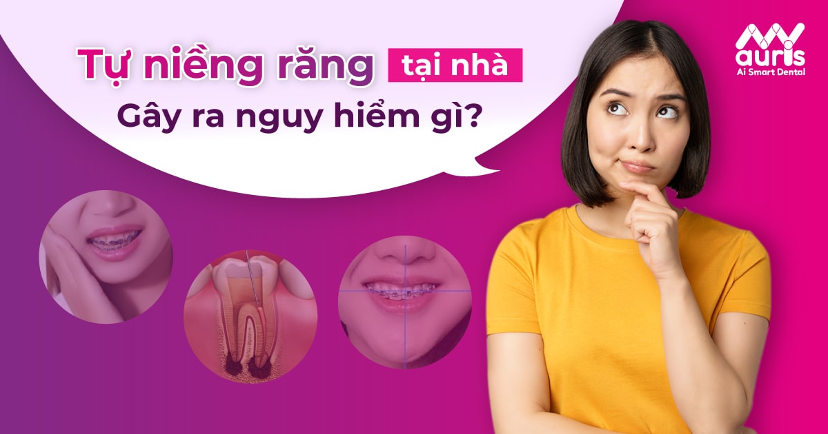 Tự niềng răng tại nhà và những điều cần biết