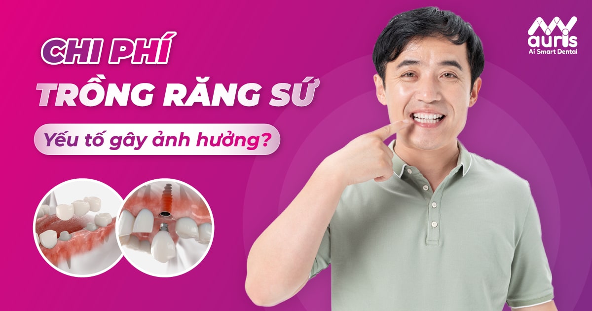 Các yếu tố làm ảnh hưởng đến chi phí trồng răng sứ