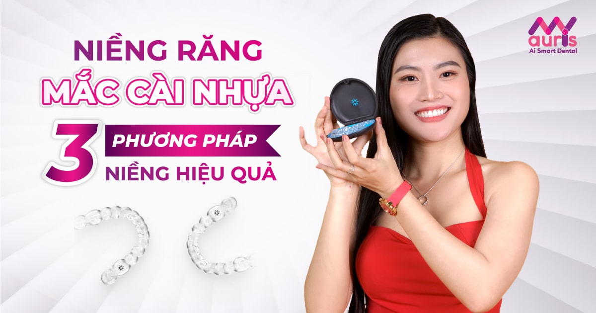 3 phương pháp niềng răng mắc cài nhựa hiệu quả cao