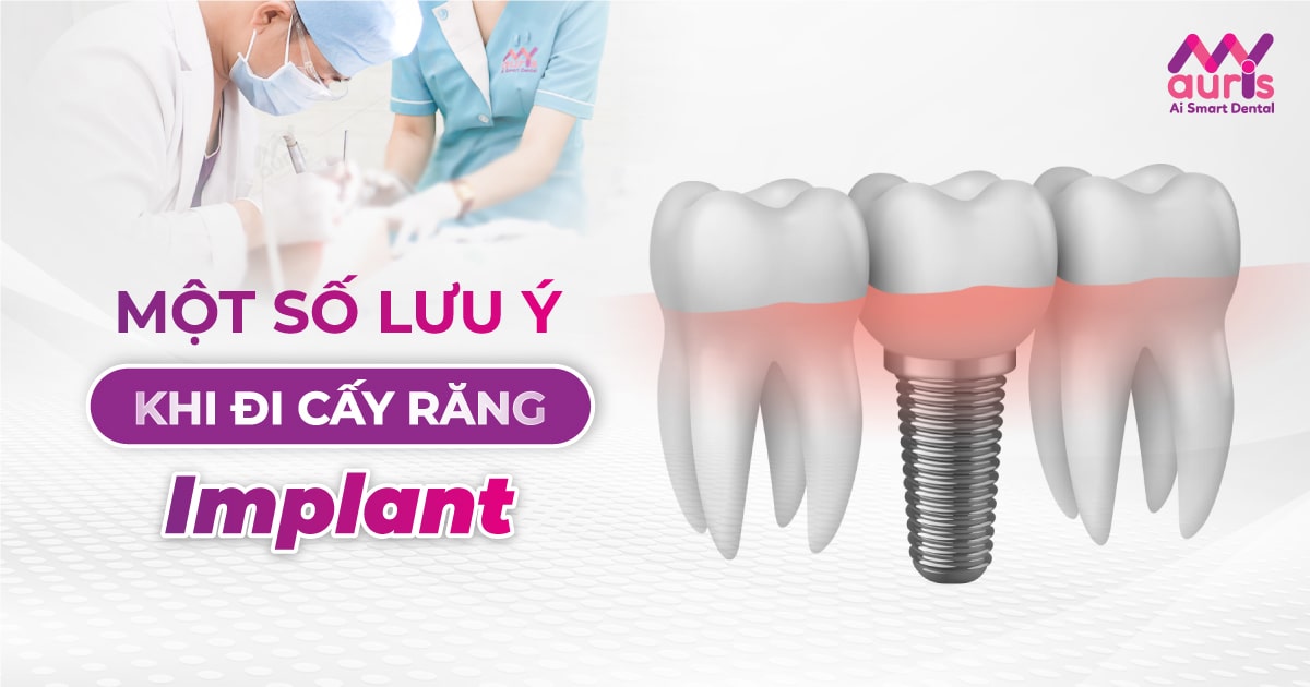 đi cấy implant