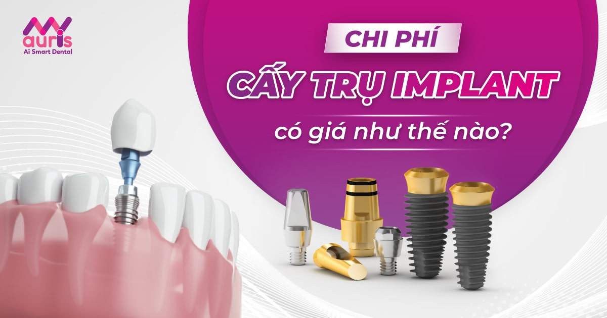 chi phí cấy implant