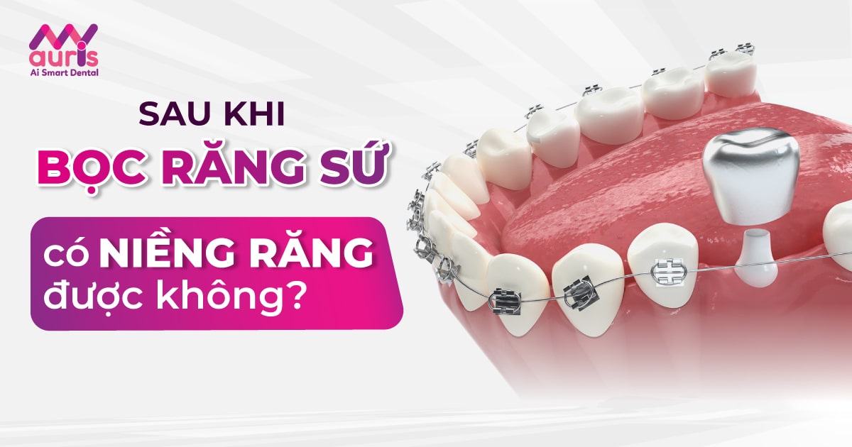 bọc răng sứ rồi có niềng được không