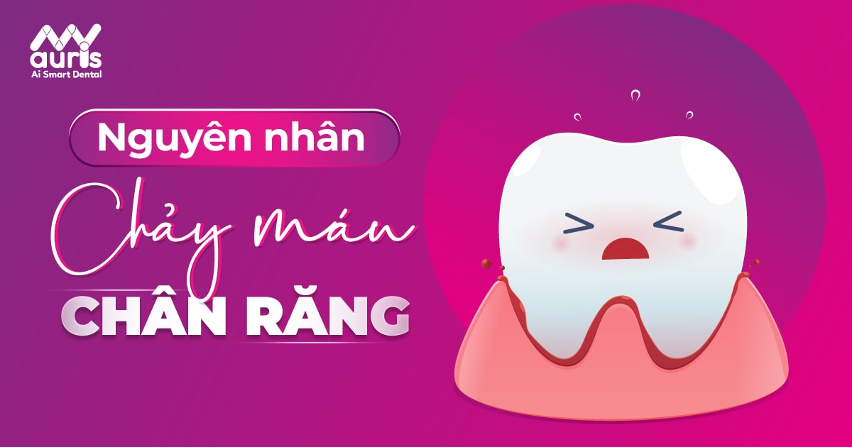 chảy máu chân răng là bệnh gì