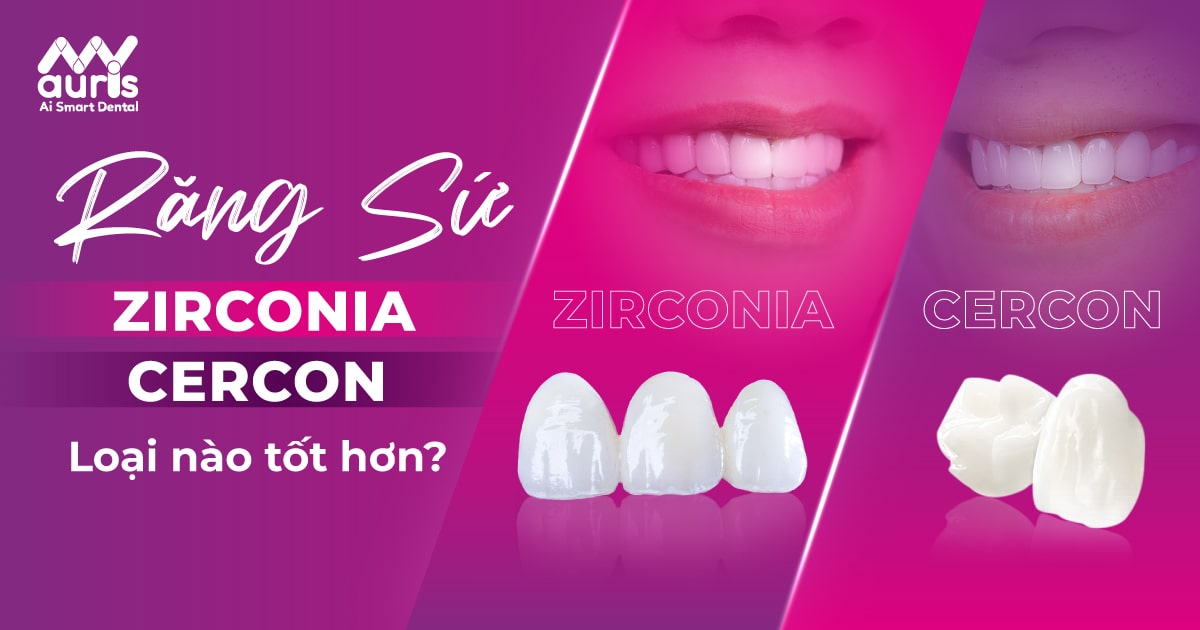 răng zirconia và cercon loại nào tốt hơn