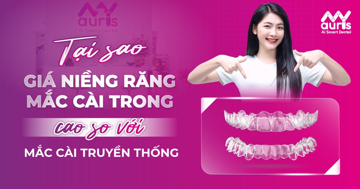 niềng răng mặt trong giá