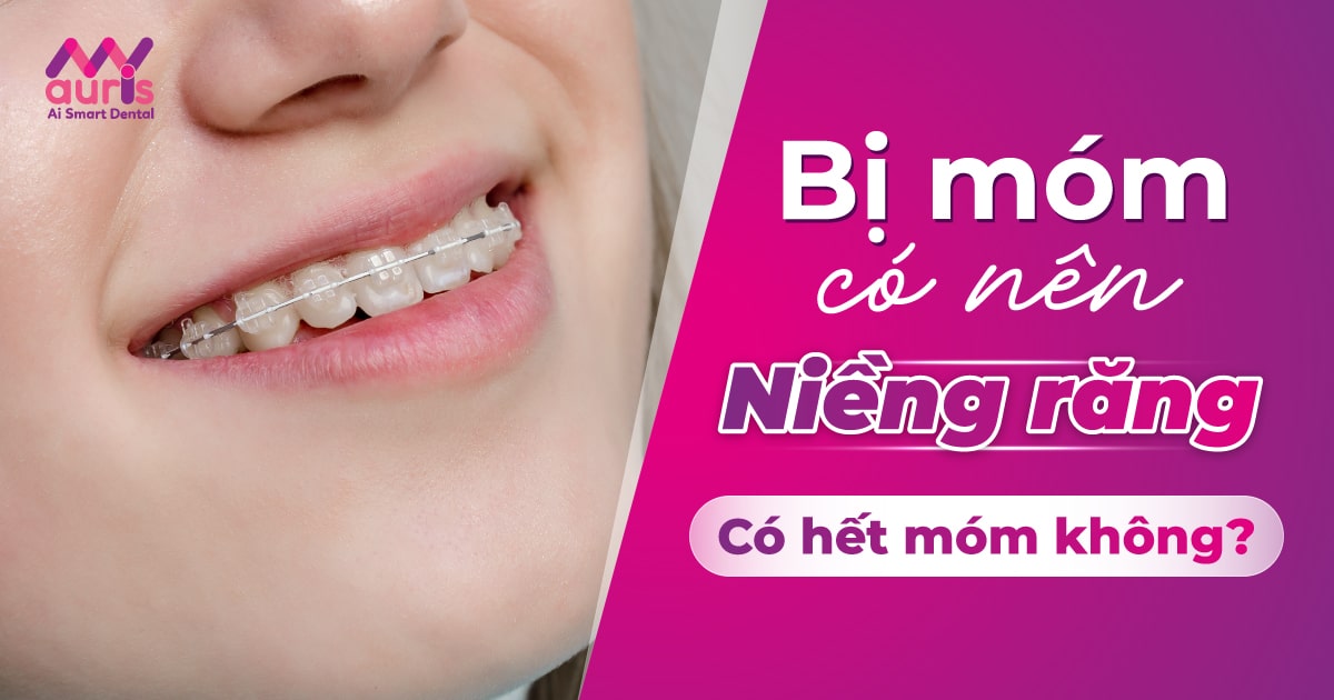 bị móm có nên niềng răng