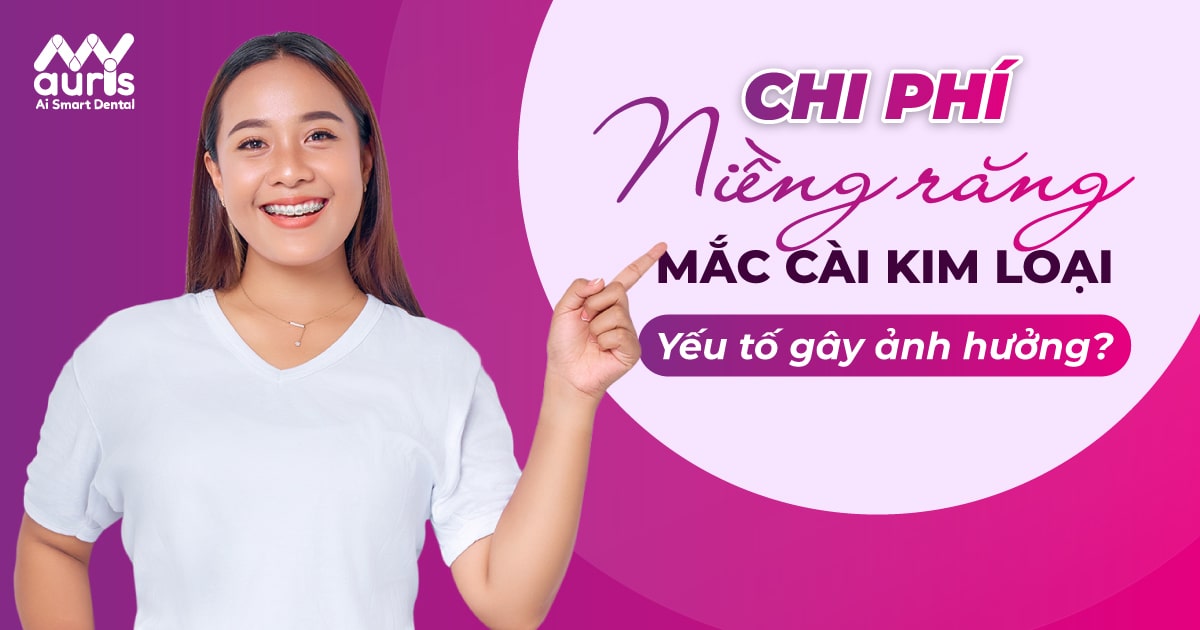 Chi phí niềng răng mắc cài kim loại và yếu tố ảnh hưởng