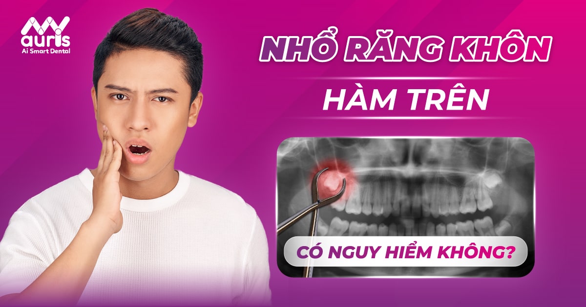 nhổ răng khôn hàm trên có nguy hiểm không?