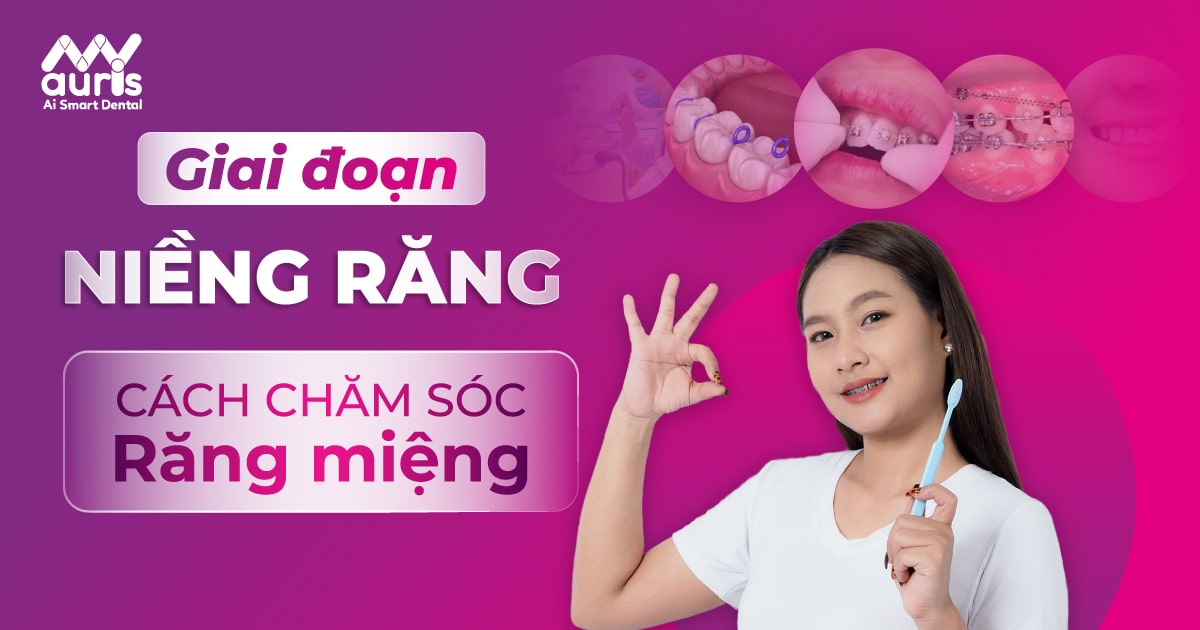 6 giai đoạn niềng răng và các cách chăm sóc răng miệng