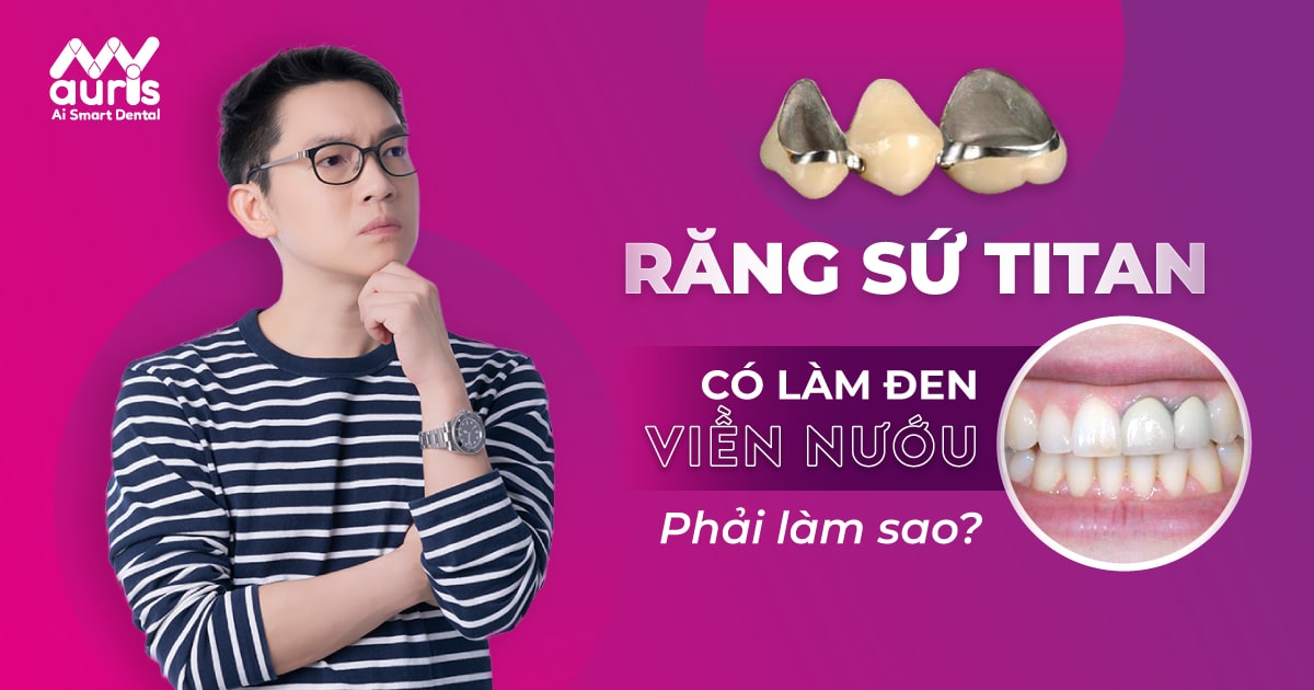 răng sứ titan có làm đen viền nướu