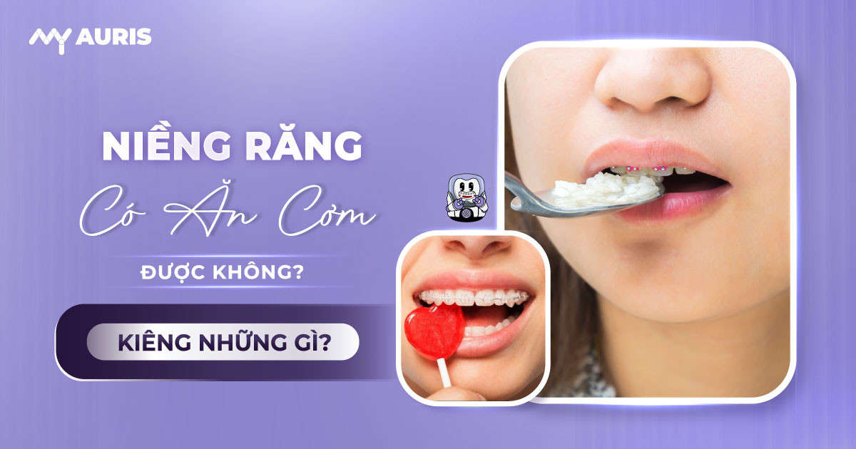 niềng răng có ăn cơm được không