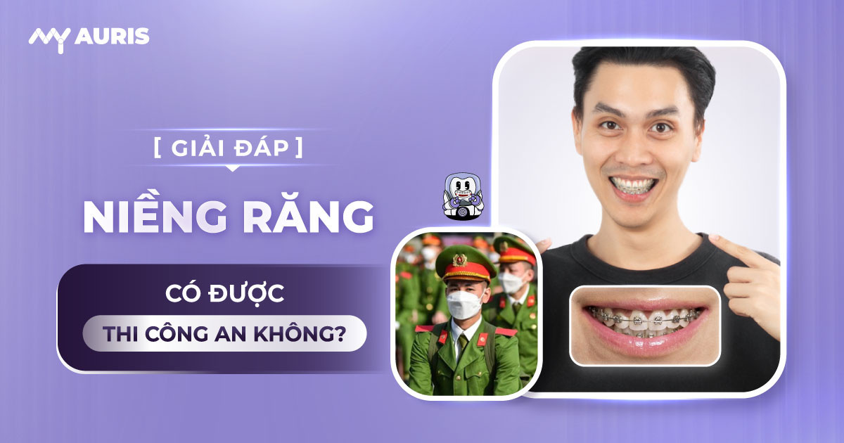 niềng răng có được thi công an không