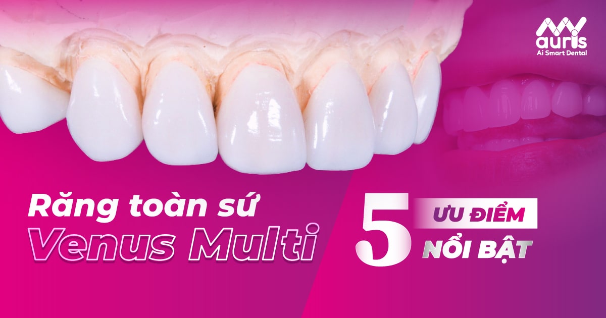 Răng toàn sứ Venus Multi và 5 ưu điểm nổi bật