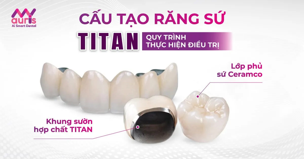 Tìm hiểu cấu tạo răng sứ Titan và quy trình thực hiện