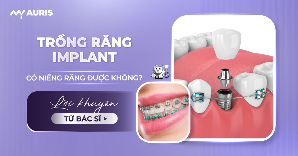 trồng răng implant có niềng răng được không,cắm implant có niềng răng được không,cắm implant rồi có niềng răng được không,cấy implant có niềng răng được không,nên niềng răng hay cắm implant,răng implant có niềng được không,trồng răng implant có niềng được không