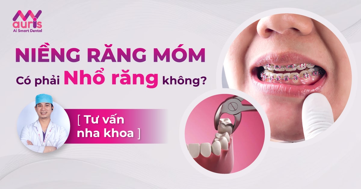 niềng răng móm có phải nhổ răng không