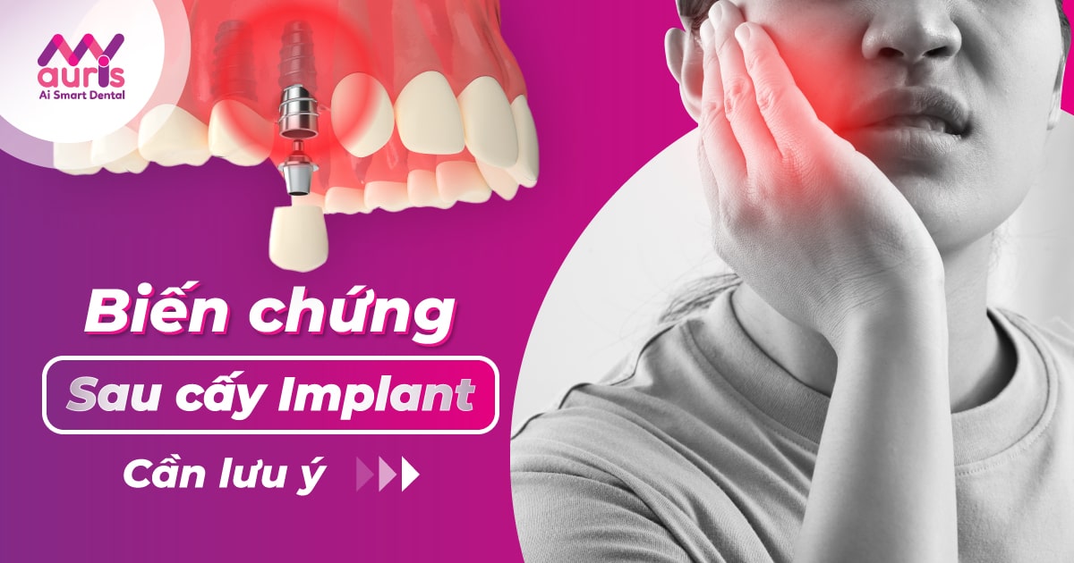 7 biến chứng sau cấy Implant cần lưu ý và cách khắc phục