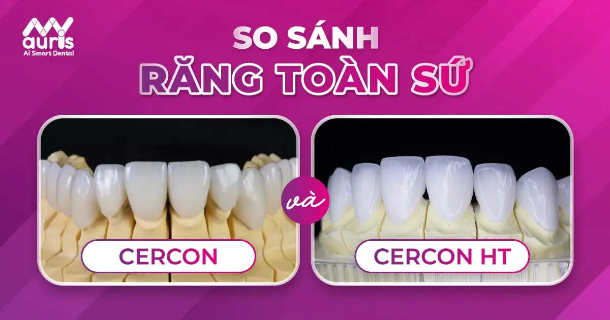 răng sứ cercon và cercon ht