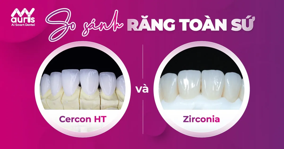 răng sứ cercon ht và zirconia