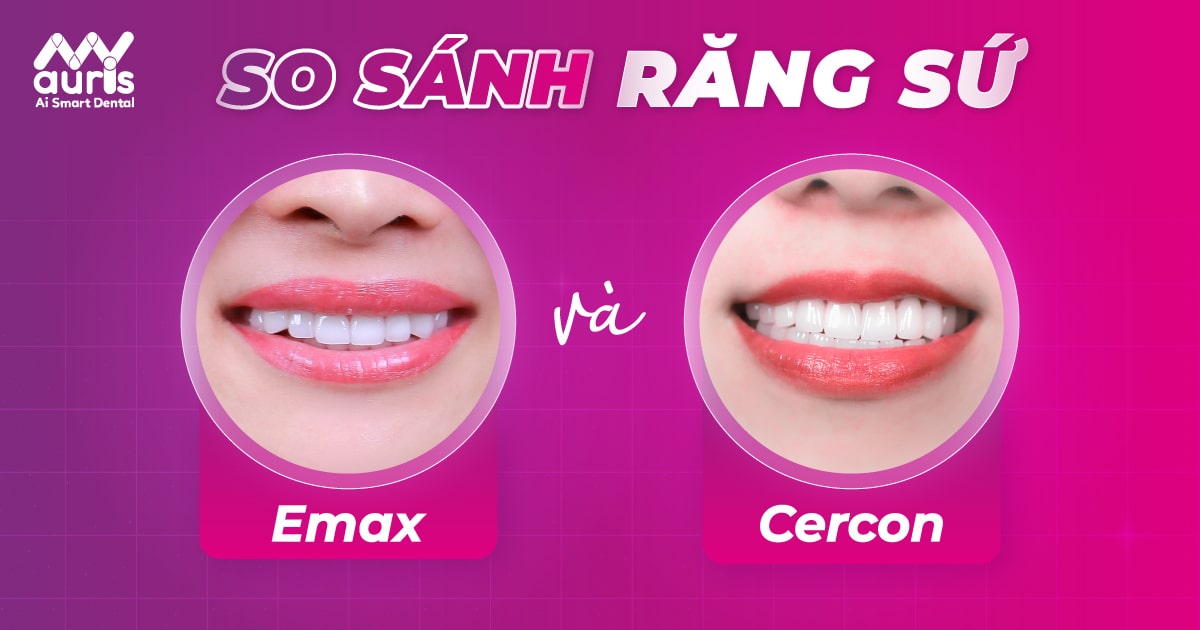 so sánh răng sứ emax và cercon