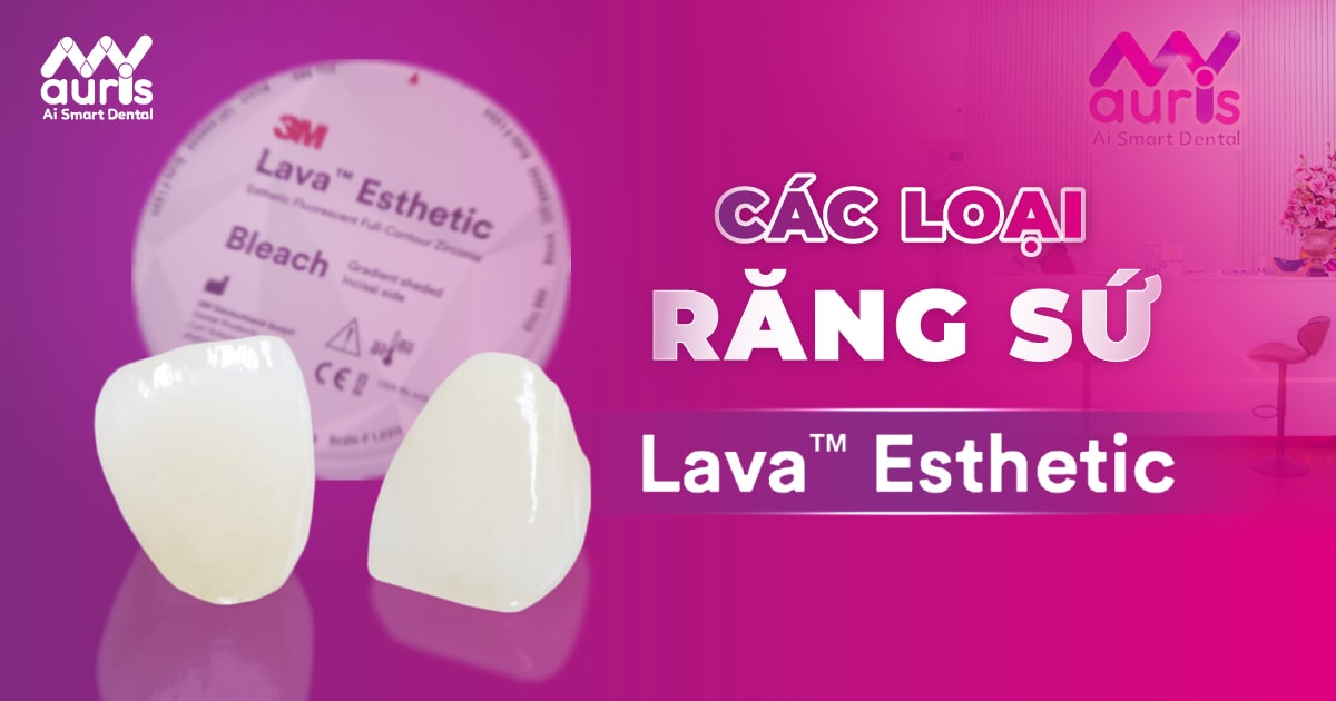 Răng sứ Lava Esthetic có thể trọng lượng như thế nào?
