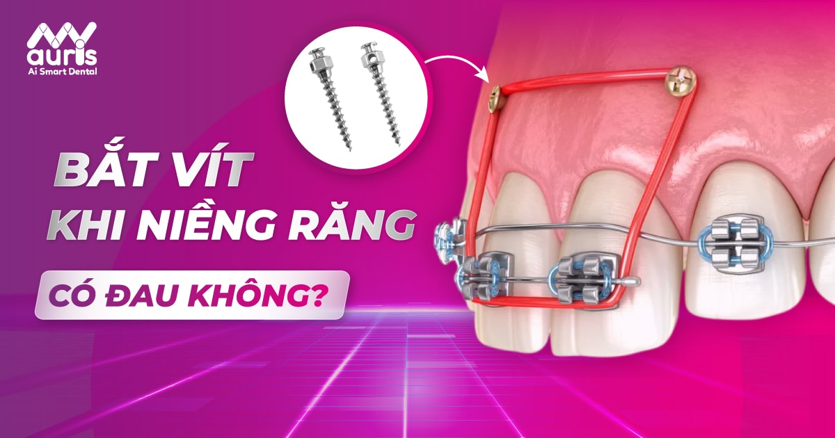 bắt vít niềng răng có đau không