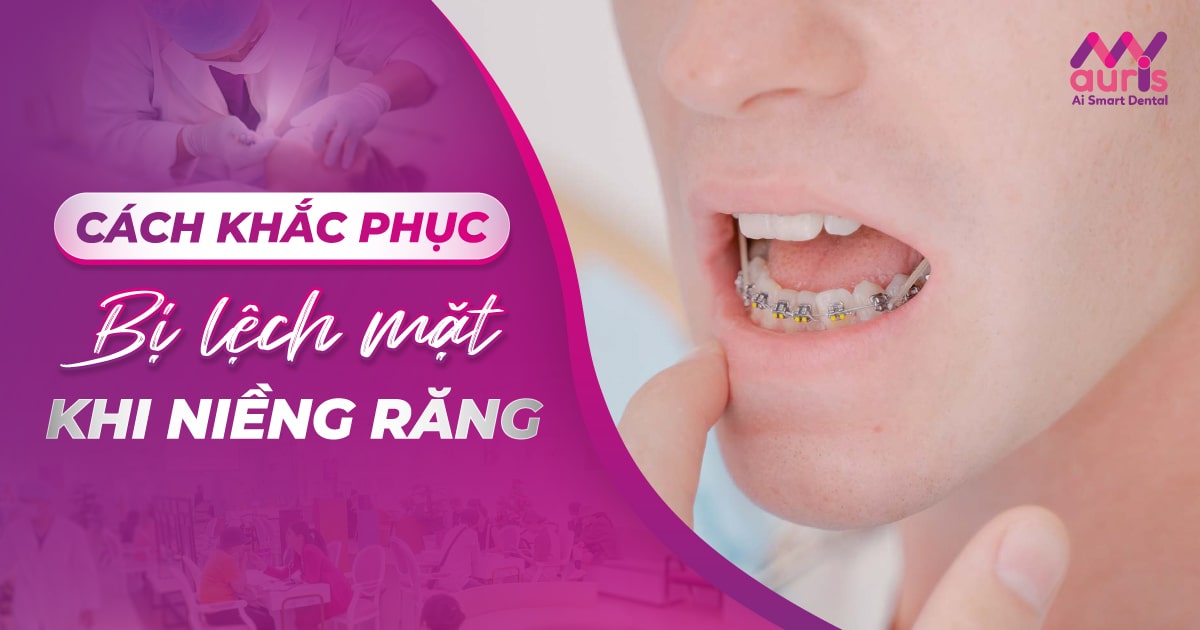 bị lệch mặt khi niềng răng