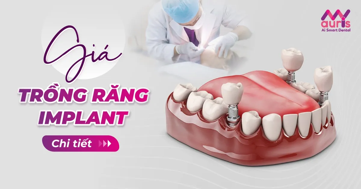 trồng răng cấm implant giá bao nhiêu