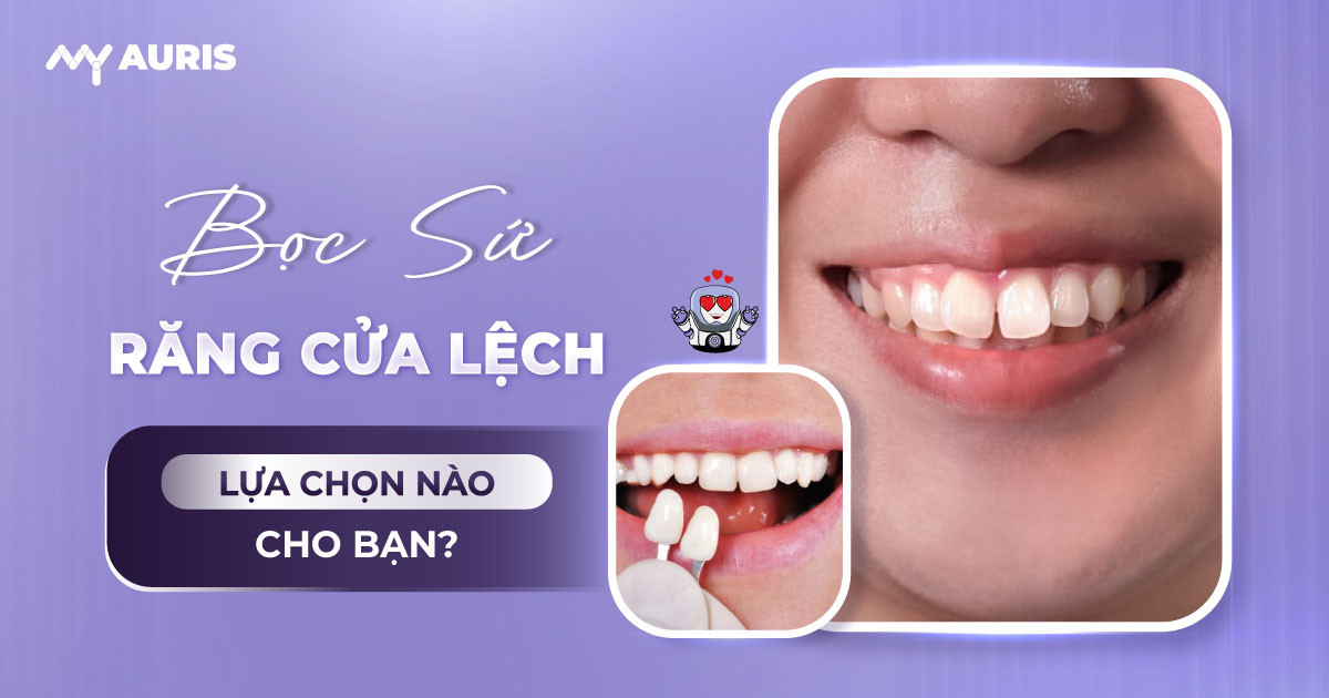 bọc sứ răng cửa bị lệch,bọc răng sứ cho răng cửa mọc lệch,bọc răng sứ răng cửa lệch