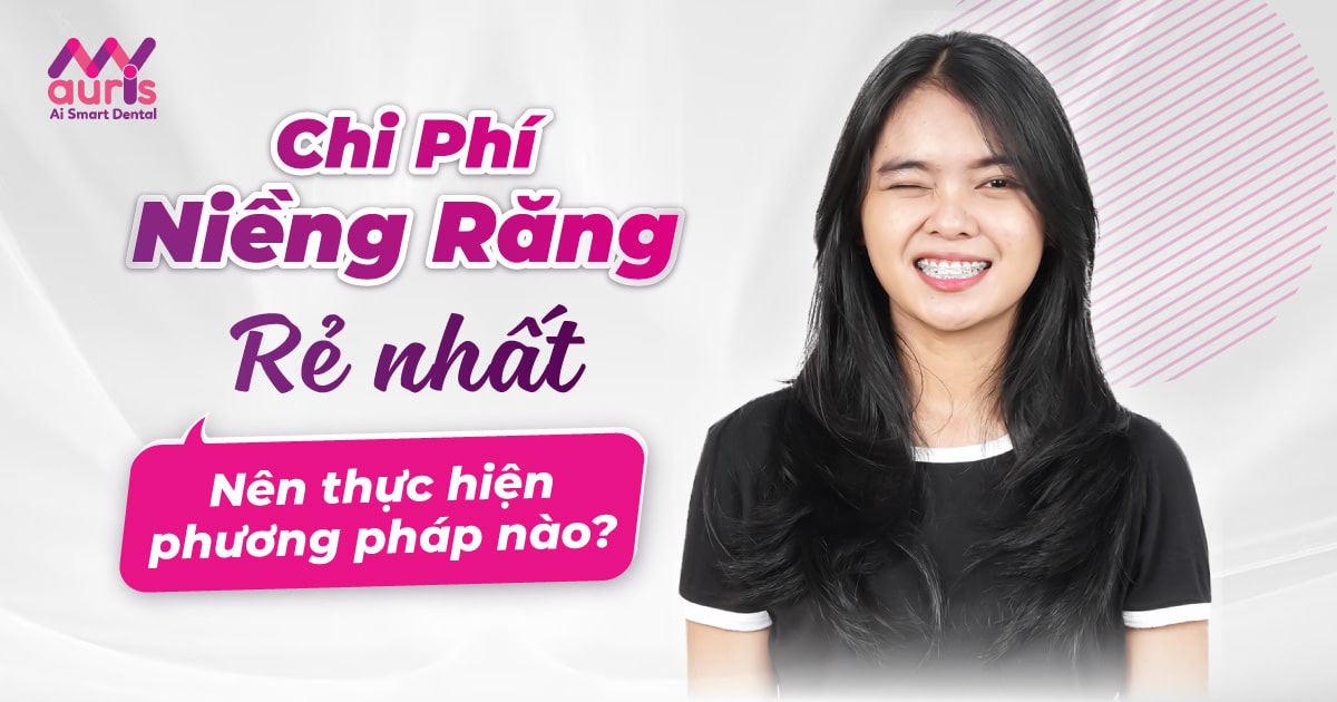 Chi phí niềng răng rẻ nhất