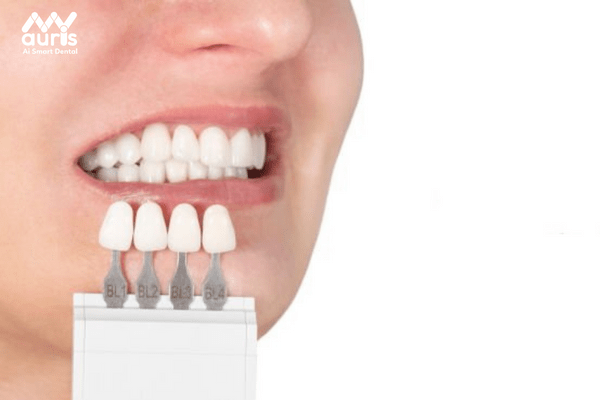 Giải đáp chữa răng hô bằng cách bọc răng sứ nên hay không?