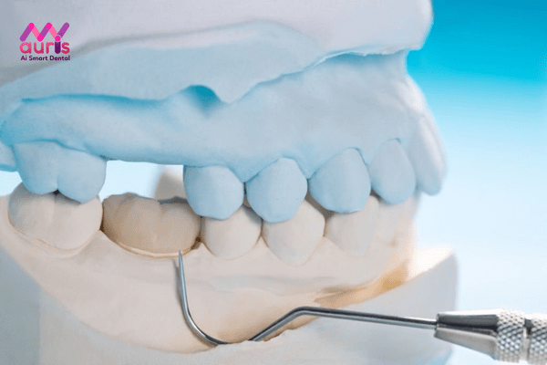 Những trường hợp thích hợp thực hiện bọc sứ cho răng hô