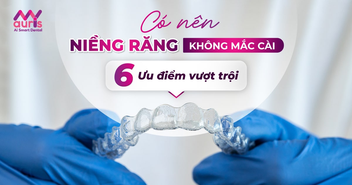 có nên niềng răng không mắc cài