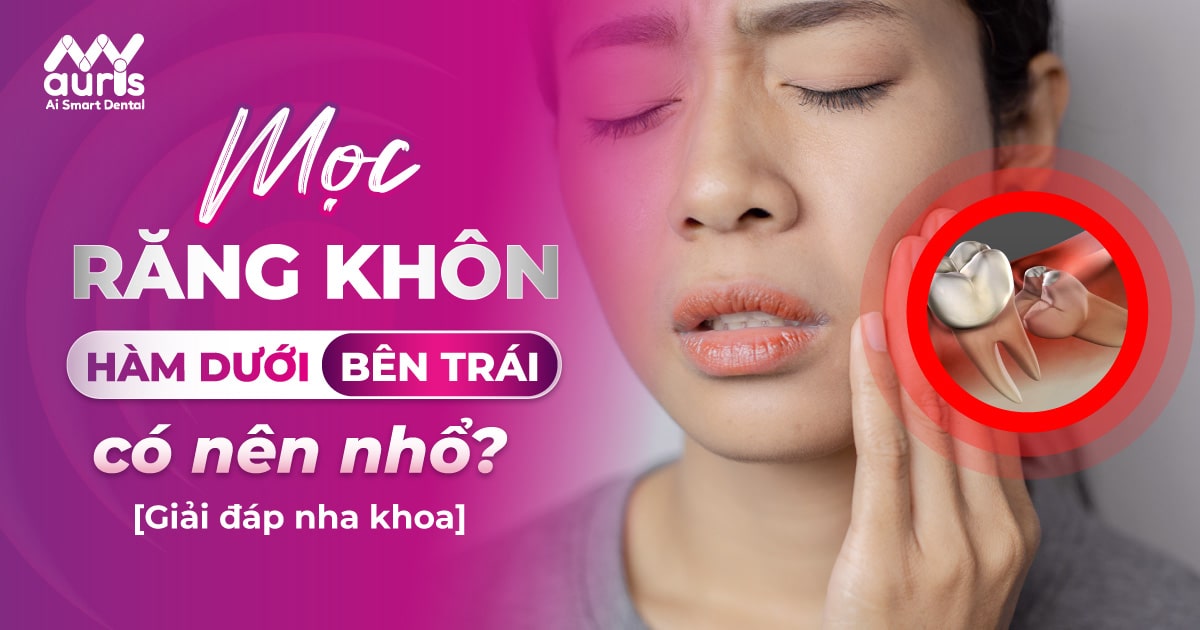 Quá trình mọc răng khôn hàm dưới bên trái kéo dài bao lâu?
