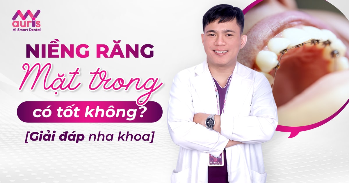 niềng răng mặt trong có tốt không