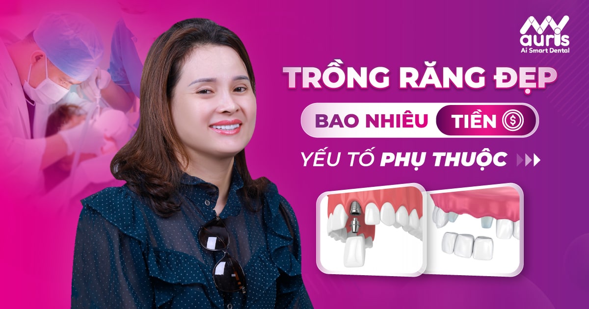 trồng răng đẹp bao nhiêu tiền