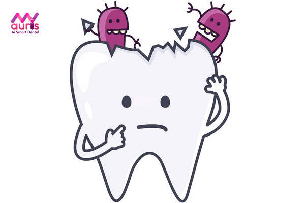 Những trường hợp cần thực hiện lấy tủy trước khi bọc răng sứ