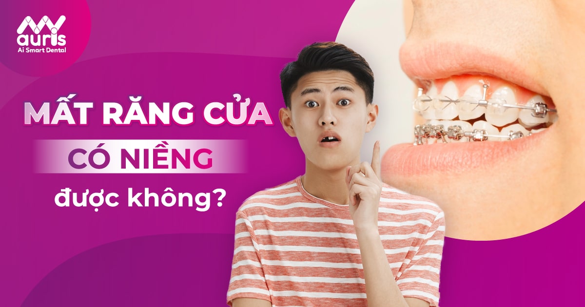 Mất răng cửa có niềng được không và cách điều trị là gì?