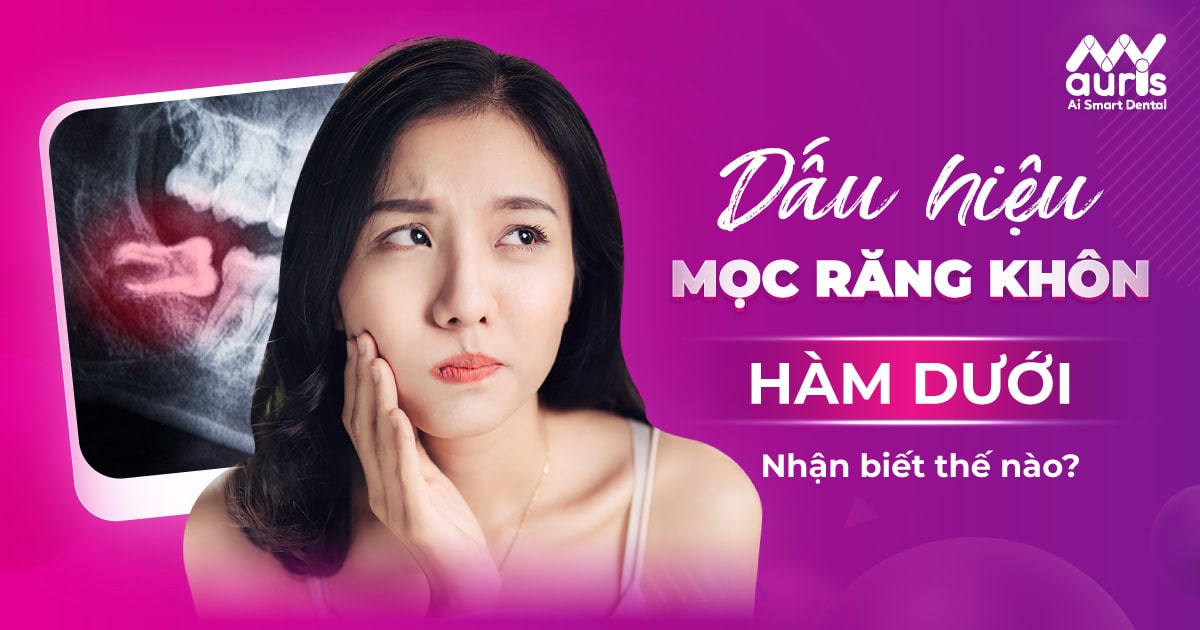 dấu hiệu mọc răng khôn hàm dưới