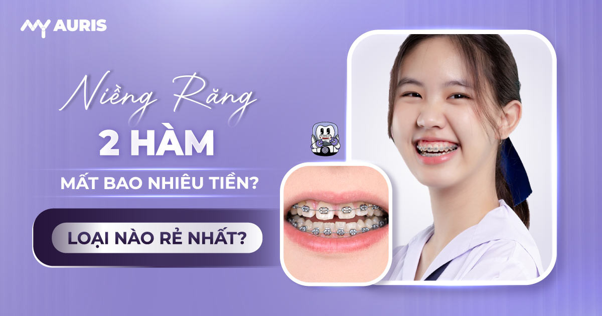niềng răng 2 hàm mất bao nhiêu tiền,niềng răng hai hàm giá bao nhiêu