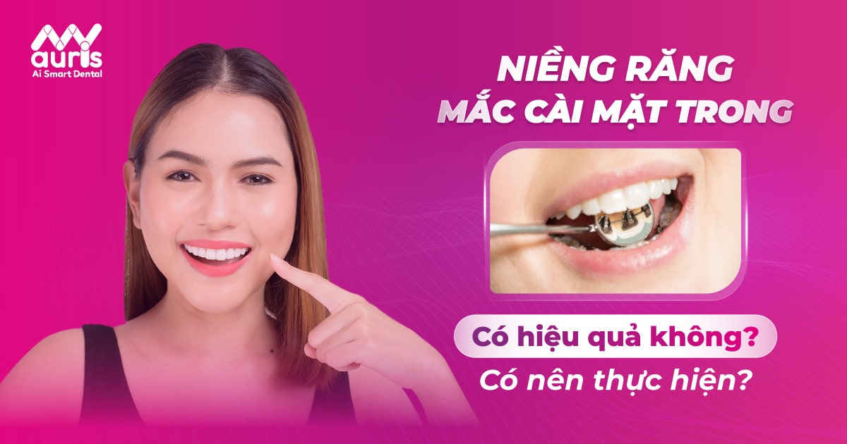 Niềng răng mặt trong có hiệu quả không