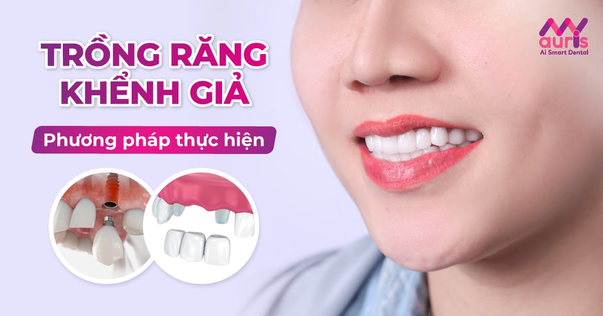 Trồng răng khểnh giả: Phương pháp và quy trình thực hiện