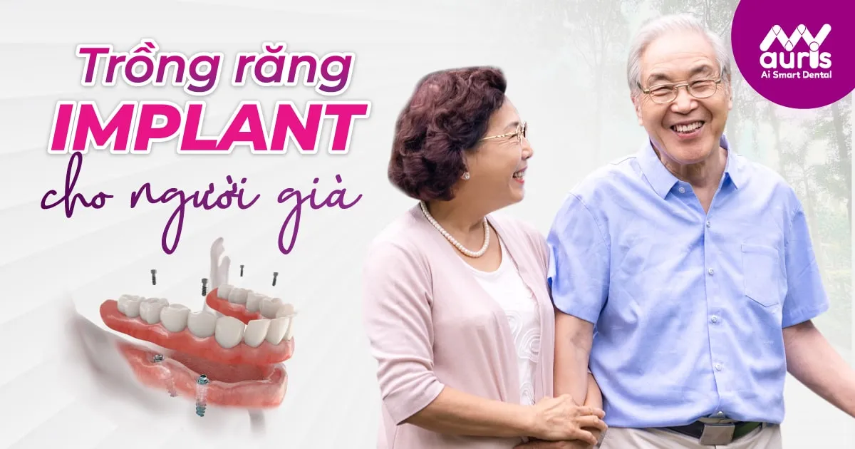 5 bước quy trình trồng răng Implant cho người già