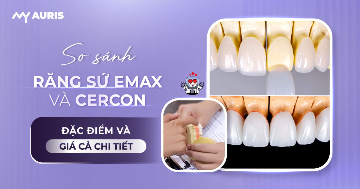 răng sứ emax và cercon,dán răng sứ emax và cercon,so sánh răng sứ emax và cercon