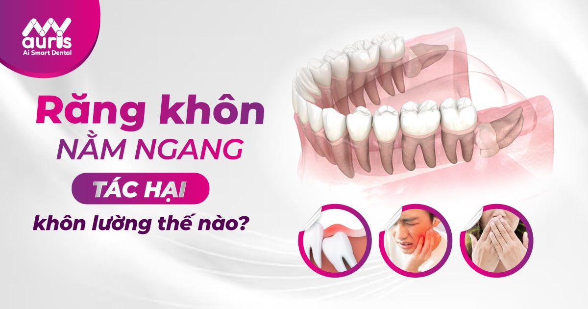 Có những triệu chứng nào cho thấy răng khôn đang mọc ngang?
