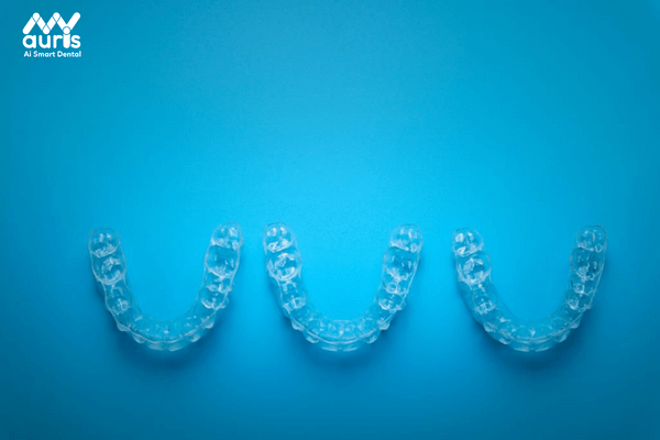 Điểm còn hạn chế của Invisalign