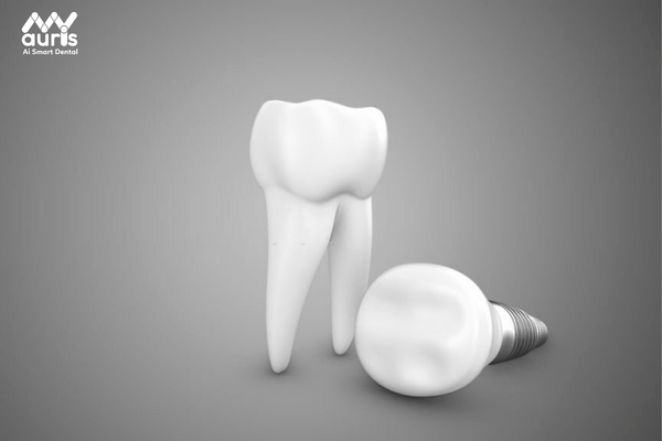 Trồng răng sứ cố định với phương pháp nào tốt nhất?