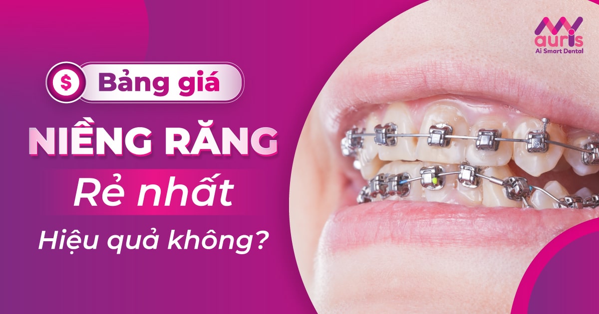 bảng giá niềng răng rẻ nhất