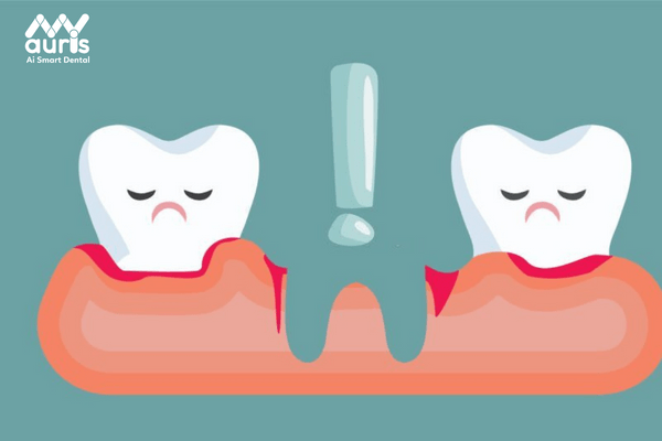Vì sao bạn nên trồng răng giả khi bị mất răng?